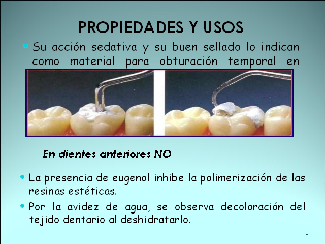 ventana comerciante Teoría básica 3.3 Fosfato de zinc - Materiales dentales UV-RMD