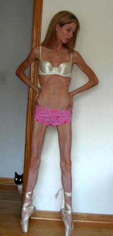 Sexo Teen Skinny Anorexic Pics 36