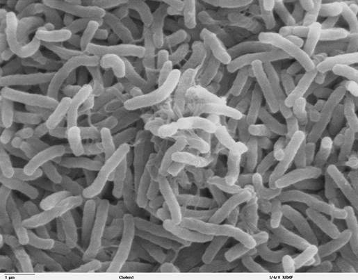 Imagen:Cholera bacteria SEM.jpg