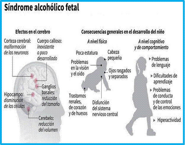 sindrome de alcoholismo fetal consecuencias