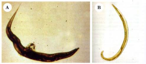 Enterobius vermicularis hembra y macho - Oxiuros hembra y macho, Enterobius vermicularis hembra