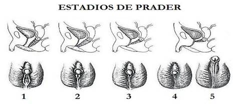 Pseudohermafroditismo
