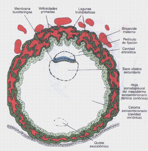 Resultado de imagen para QUISTES EXOCELOMICOS