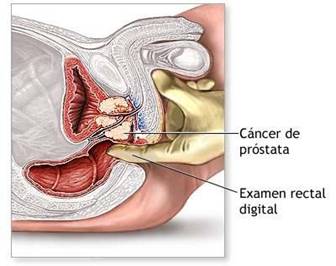 Nu uita de consultul urologic anual!