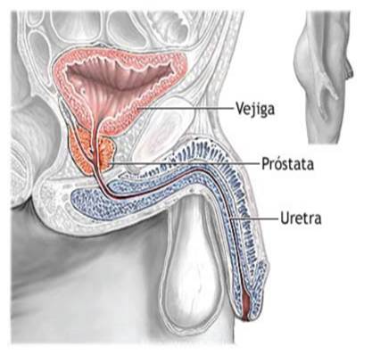 sonda la prostata