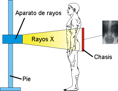 Los Rayos X